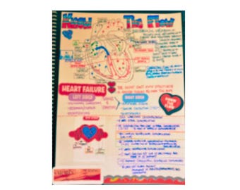 Blood Flow Through the Heart - PDF Instant Download - Etsy