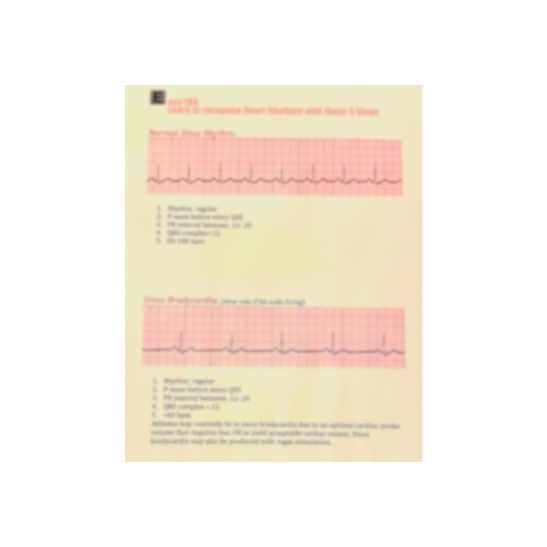 EASY EKG Identifying Heart Rhythms in 5 Easy Steps - Etsy