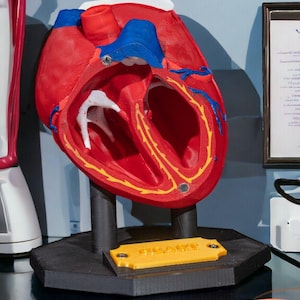May include: A red anatomical heart model with a cutaway view of the chambers and valves. The model is on a black stand with a yellow label that reads "Remarkable".