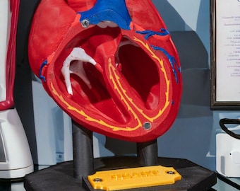 May include: A red anatomical heart model with a cutaway view of the chambers and valves. The model is on a black stand with a yellow label that reads "Remarkable".