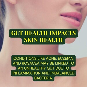 May include: A close-up image of a woman's face and neck with the text "GUT HEALTH IMPACTS SKIN HEALTH" and "CONDITIONS LIKE ACNE, ECZEMA, AND ROSACEA MAY BE LINKED TO AN UNHEALTHY GUT DUE TO INFLAMMATION AND IMBALANCED BACTERIA."