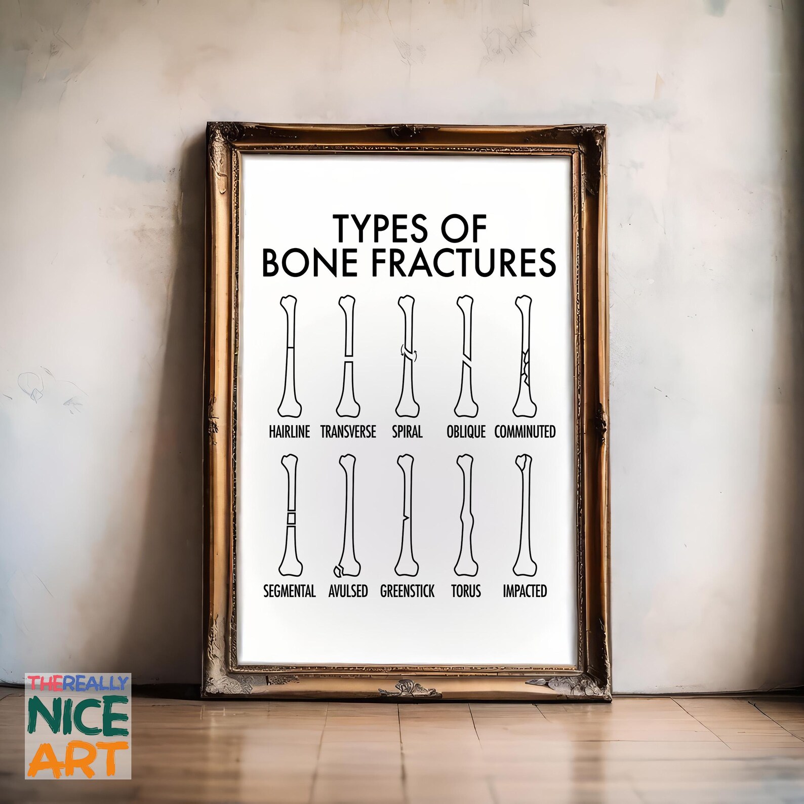 Image showcasing Bone Fractures PRINTABLE Wall Art, Detailed Medical Illustration ...