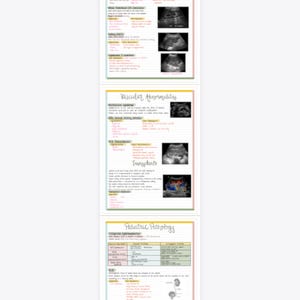The Urinary System Study Guide - Etsy