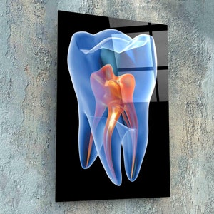 Dental Clinic Wall Decor, Dentist Office Wall Art, Tooth Wall Art, X-Ray View Tooth Wall Art, Dentist Gifts, Dental Clinic Gifts