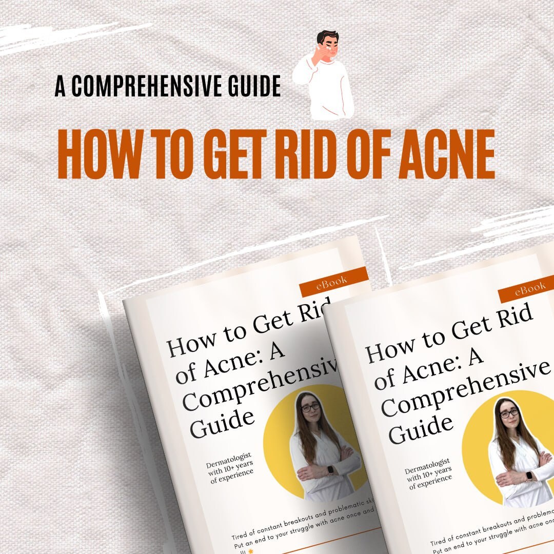 How to Get Rid of Acne an Effective Guide for Clear and Healthy Skin ...