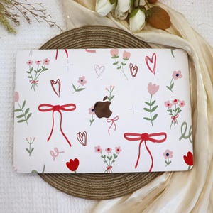 Bows & Flowers MacBook Case,New MacBook 2025 Air 15/13 Cover,Apple Laptop Sleeve,Pro 13/14/15/16,2024/2022/2020,M1 M2 M3 M4,Custom Case