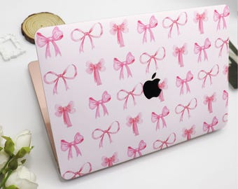 Niedliche Rosa Bogen Muster MacBook Fall Harte Schützende Laptop Fall Macbook Air Pro Abdeckung Für Macbook Air 15/13/11 Pro 16/14 Fall 2023 2022 2021