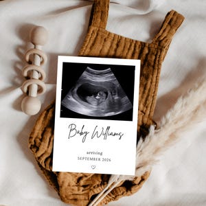 Ultrasound Photo Pregnancy Announcement Template, We’re Expecting Printable Card, Baby Reveal Announcement Card, 5x7, Editable in Canva
