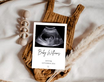 Ultrasound Photo Pregnancy Announcement Template, We’re Expecting Printable Card, Baby Reveal Announcement Card, 5x7, Editable in Canva