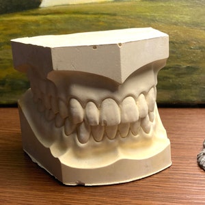 Vintage Dental Teeth big / oversized and heavy Plaster Cast Model Mold