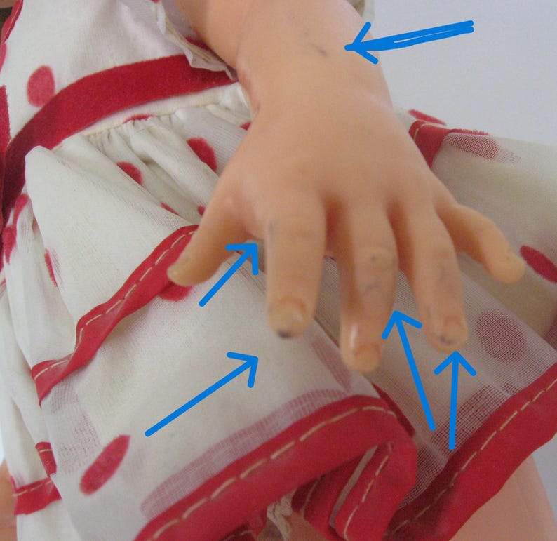 May include: A doll wearing a white dress with red polka dots and red trim. The doll's arm and hand feature several small dark spots, which are highlighted by blue arrows pointing to the specific areas of discoloration on the skin surface.
