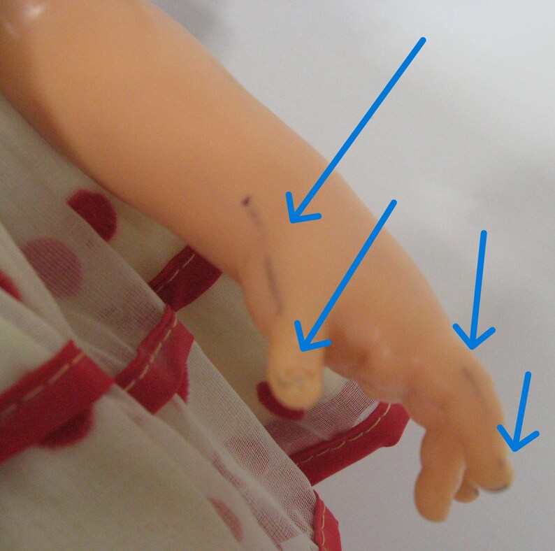 May include: A peach-toned plastic doll arm and hand featuring several dark ink marks on the skin, highlighted by four bright blue arrows pointing to the specific areas of discoloration on the wrist, thumb, and fingers, worn with a white dress.