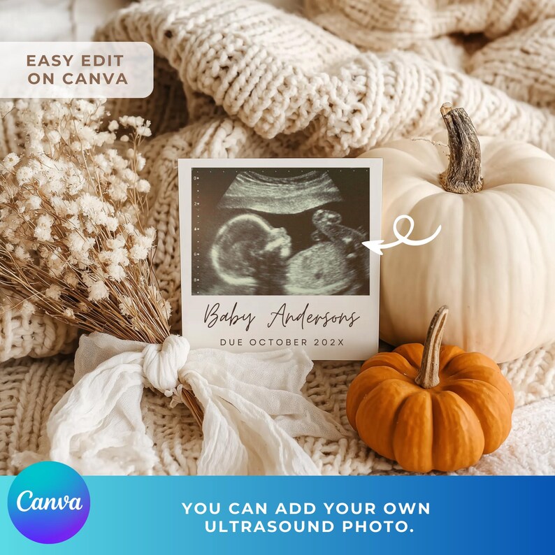 K&ouml;nnte beinhalten: Eine Schwangerschaftsank&uuml;ndigung mit einem Ultraschallbild und dem Text "Baby Andersons Due October 202X." Das Bild ist vor einem wei&szlig;en K&uuml;rbis, einem orangefarbenen K&uuml;rbis und Trockenblumen platziert. Der Text "Easy Edit on Canva" ist ebenfalls sichtbar.