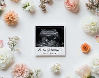 Floral Pregnancy Announcement Template: Editable Neutral Baby Reveal (Digital Download)