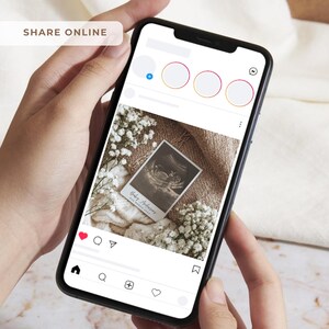 Peut inclure: Un smartphone affiche une publication Instagram avec une image d'&eacute;chographie. La publication comprend une photo d'&eacute;chographie de b&eacute;b&eacute;, entour&eacute;e de fleurs et d'une couverture tricot&eacute;e. Le texte "Share Online" est visible.