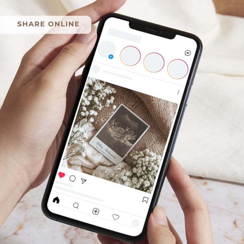 Peut inclure: Un smartphone affiche une publication Instagram avec une image d'&eacute;chographie. La publication comprend une photo d'&eacute;chographie de b&eacute;b&eacute;, entour&eacute;e de fleurs et d'une couverture tricot&eacute;e. Le texte "Share Online" est visible.