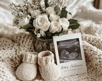 Digital Pregnancy Announcement Minimalist Ultrasound Reveal Editable Baby Announcement Template for Canva Modern Social Media Post
