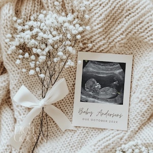 以下が含まれることがあります： 赤ちゃんの超音波画像が写った妊娠発表カード。カードは、クリーム色のニットブランケットの上に置かれ、クリーム色のリボンで結ばれた白い花のブーケの隣にあります。カードには「Baby Andersons, Due October 202X」と書かれています。