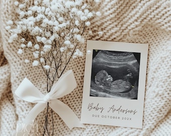 Plantilla minimalista para anuncio de embarazo, anuncio moderno para bebé, anuncio digital en redes sociales, ideas neutrales para anuncios de bebé, plantilla editable