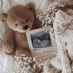 Neutral Minimalist Teddy Bear Pregnancy Announcement Digital Baby Reveal Editable Canva Template Cozy Baby Announcement Social Media