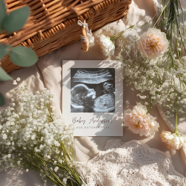 Floral Pregnancy Announcement Template Ultrasound Baby Reveal Neutral Baby Announcement Editable Canva Template Digital Download