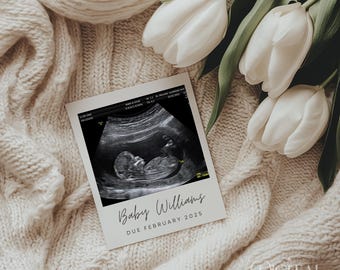 May include: A white card with a black and white ultrasound image of a baby. The text "Baby Williams Due February 2025" is written on the card.