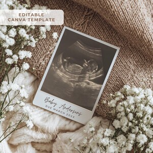 Peut inclure: Une carte d'annonce de grossesse avec une image d'&eacute;chographie d'un b&eacute;b&eacute;. La carte indique "Baby Anderson" et "Due March 202X". La carte est entour&eacute;e de fleurs blanches et repose sur une couverture en tricot beige. Le coin sup&eacute;rieur gauche de la carte indique "EDITABLE CANVA TEMPLATE".