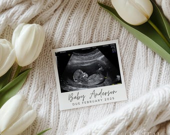May include: A sonogram image of a baby, displayed on a white card, rests on a cream-colored knitted blanket. The card reads "Baby Anderson, Due February 2025." White tulips with green stems are arranged around the card.