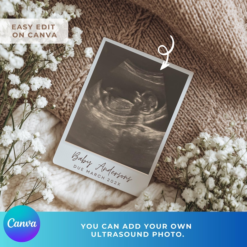 Peut inclure: Une carte blanche avec une image d'&eacute;chographie d'un b&eacute;b&eacute;, avec le texte "Baby Andersons DUE MARCH 202X". La carte est entour&eacute;e de fleurs blanches et repose sur une couverture en tricot marron. Le texte "EASY EDIT ON CANVA" est en haut &agrave; gauche.