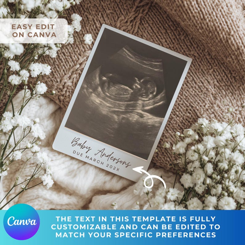 Peut inclure: Une image en niveaux de gris d'une &eacute;chographie de b&eacute;b&eacute;, avec le texte "Baby Andersons DUE MARCH 202X" sur une carte blanche. La carte est entour&eacute;e de fleurs blanches et repose sur une couverture en tricot beige. Le logo Canva est visible.