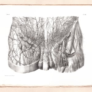 May include: A detailed grayscale anatomical illustration of the male genitalia, showcasing the vascular and muscular structures. The artwork, presented on aged paper, highlights the intricate network of veins. The image has a vintage aesthetic, with a focus on anatomical detail.