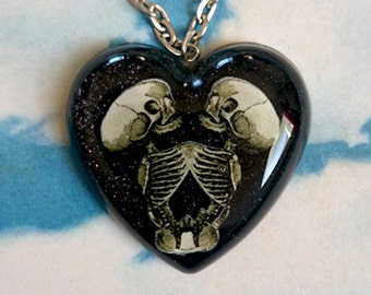 Siamese Skeleton Heart - Skulls - Baby Skeleton Twins - Black Heart - Cute & Dead - Freaks - Bones - Gothic - Glitter Paradise®