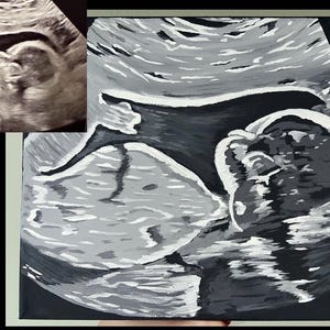 Puede incluir: Una pintura en blanco y negro de una imagen de ultrasonido de un bebé en el útero. La pintura está hecha en un estilo realista y captura el detalle de la imagen de ultrasonido.