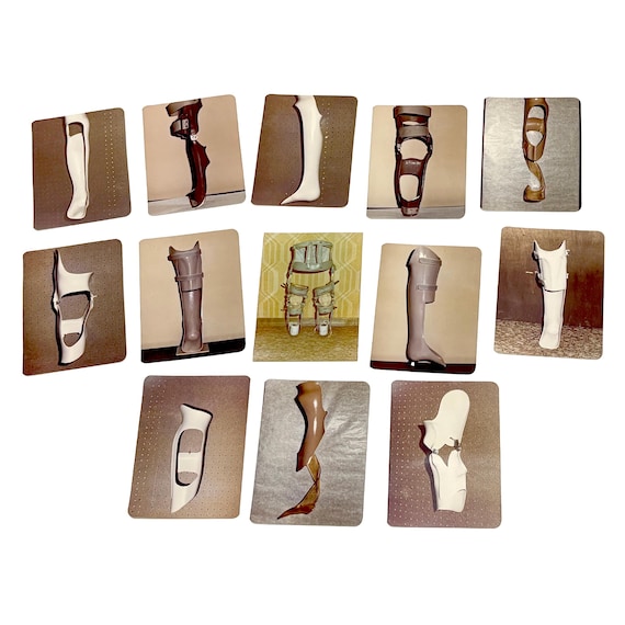 Lot of 13 Vintage Photos of Orthotic Devices, 3.5" x 5"