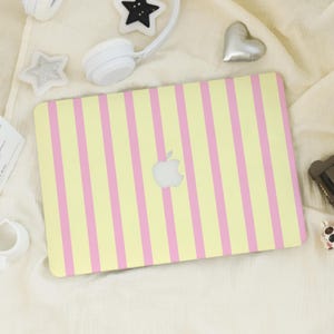 May include: A yellow laptop with vertical pink stripes. The Apple logo is visible in the center. The laptop is surrounded by white accessories, including headphones and star-shaped decorations.