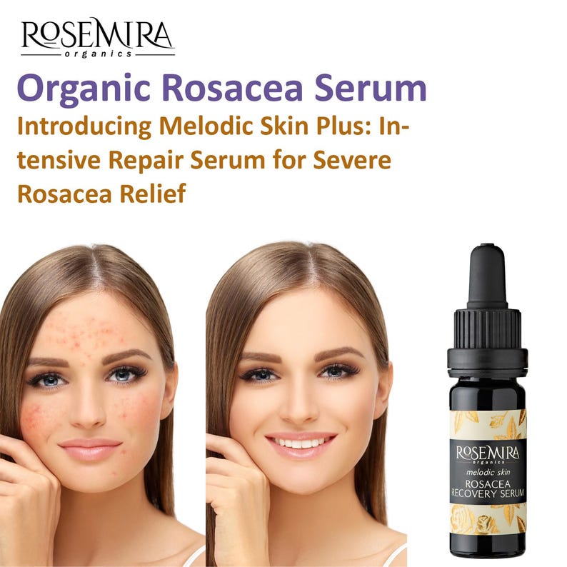 May include: Before and after photos of a person's face showing the effects of using a Rosacea Recovery Serum. The serum is in a small, clear glass bottle with a black dropper and a label that says "ROSEMIRA organics melodic skin ROSACEA RECOVERY SERUM".