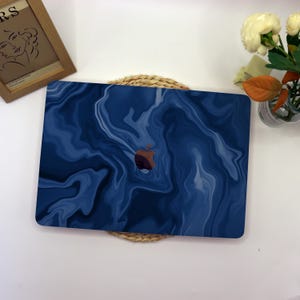 May include: Blue laptop skin with a marbled design. The skin has a light blue and dark blue swirl pattern. The Apple logo is visible in the center of the skin.