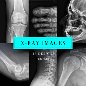 May include: A digital collection of 16 medical X-ray images in PNG format, featuring greyscale radiographic scans of human anatomy including a knee, foot, skull, elbow, cervical spine, and shoulder joint, presented with the text X-RAY IMAGES.