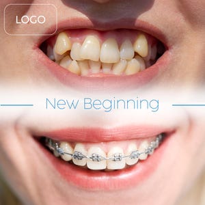 May include: Image showing a comparison of teeth before and after orthodontic treatment. The top half displays misaligned teeth, while the bottom half shows a smile with braces and straight teeth. The text "New Beginning" is featured.
