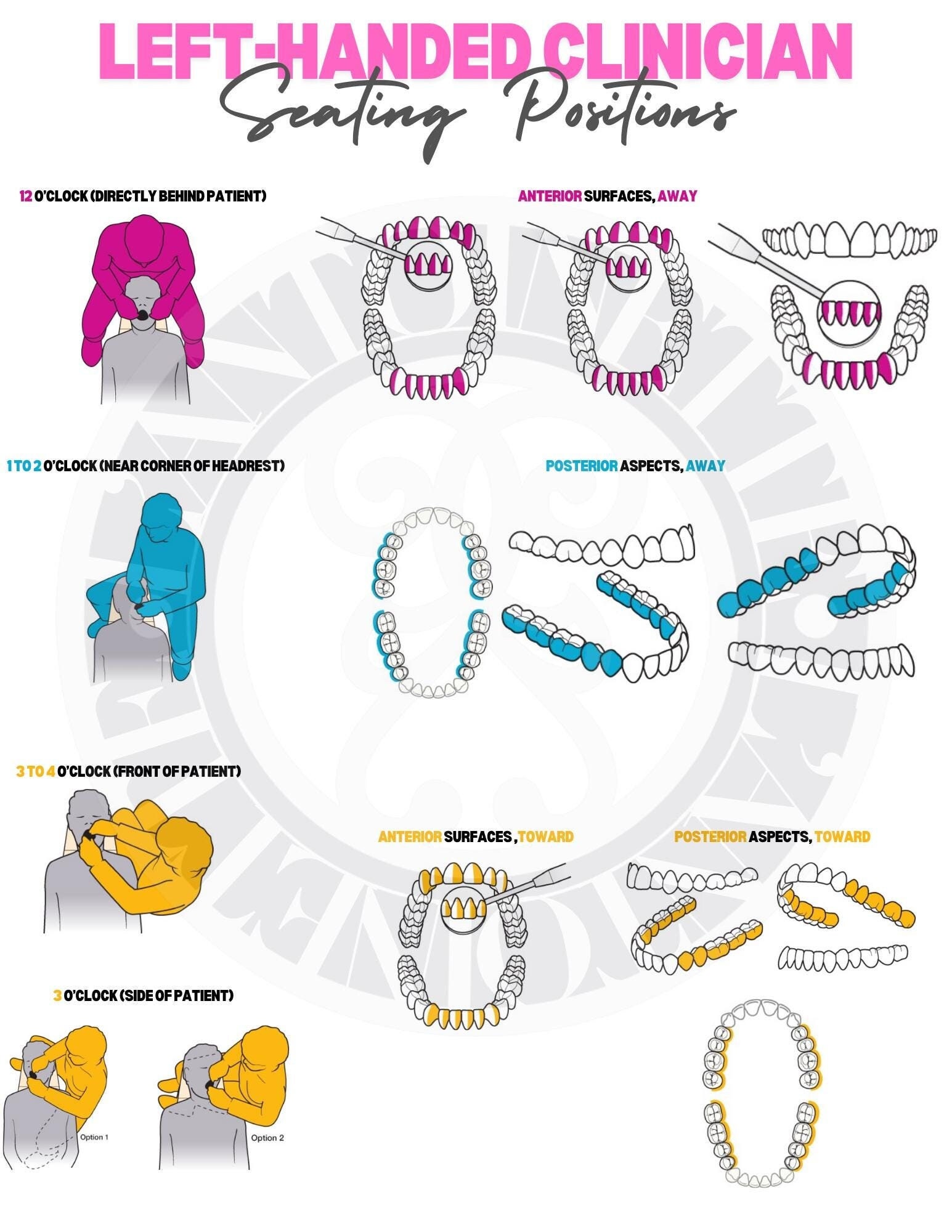 Dental Seating Positions - Left Handed - Etsy