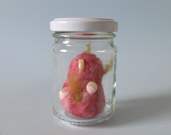 Teratoma Tumor Specimen Jar Anatomy Art