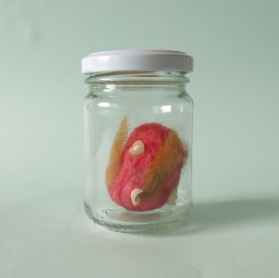 Teratoma Tumor Specimen Jar Anatomy Art Etsy teratoma-tumor-specimen-jar-anatomy-art-etsy