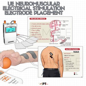 May include: Diagram illustrating neuromuscular electrical stimulation electrode placement. Includes a device with a digital display, electrode pads, and diagrams of the upper limb and back, with text labels and medical terminology.