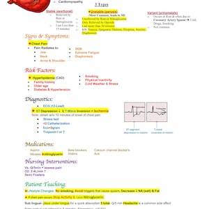 Może przedstawiać: Edukacyjna infografika medyczna zatytułowana Angina Aka Chest Pain, zawierająca ilustrację czerwonego serca oraz tekst opisujący patologię, typy, objawy, czynniki ryzyka, diagnostykę z wykresami EKG, leki, interwencje pielęgniarskie i edukację pacjenta.