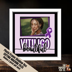 Prise de conscience du vitiligo responsabilisant les fichiers de coupe de cadre SVG, image de mémoire d'amour de soi, perte de pigment affichage de photos inspirantes 3D