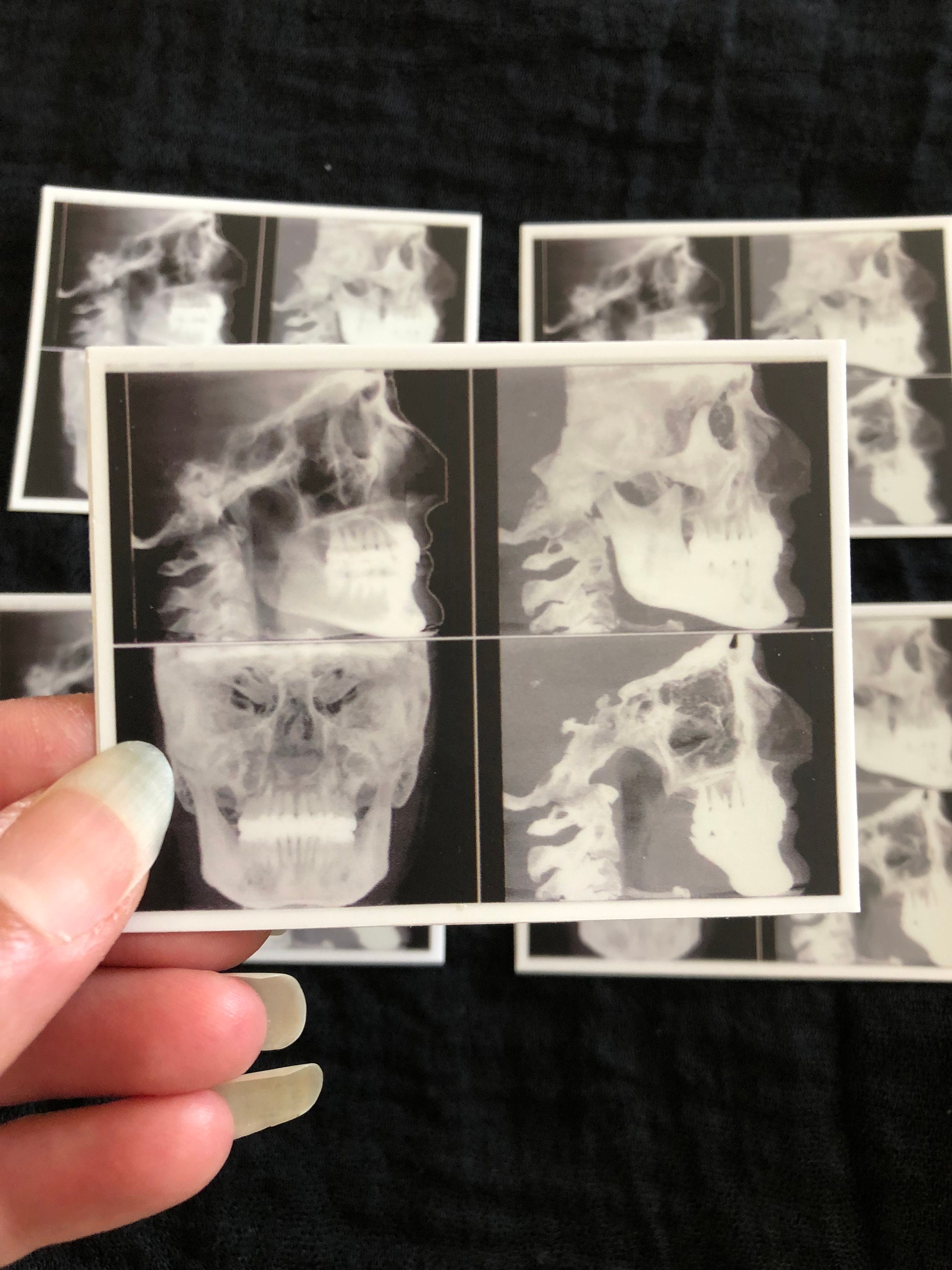 Love Me From The Inside: my X-ray sticker