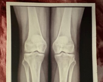 Knee X-Ray Medical Sticker, Radiology Oddities Art, Waterproof Vinyl Decal for Nurses