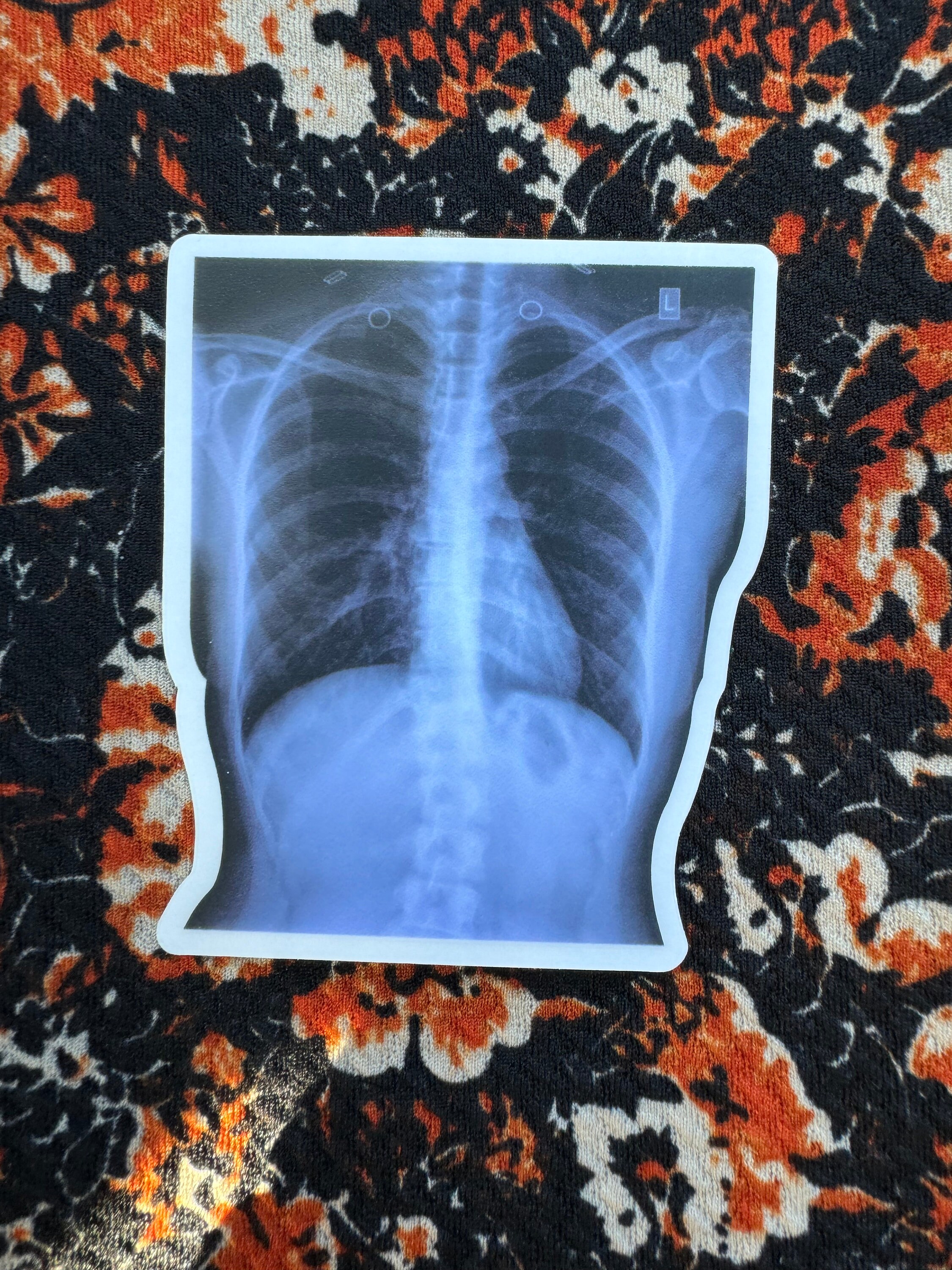 Clear X-Ray