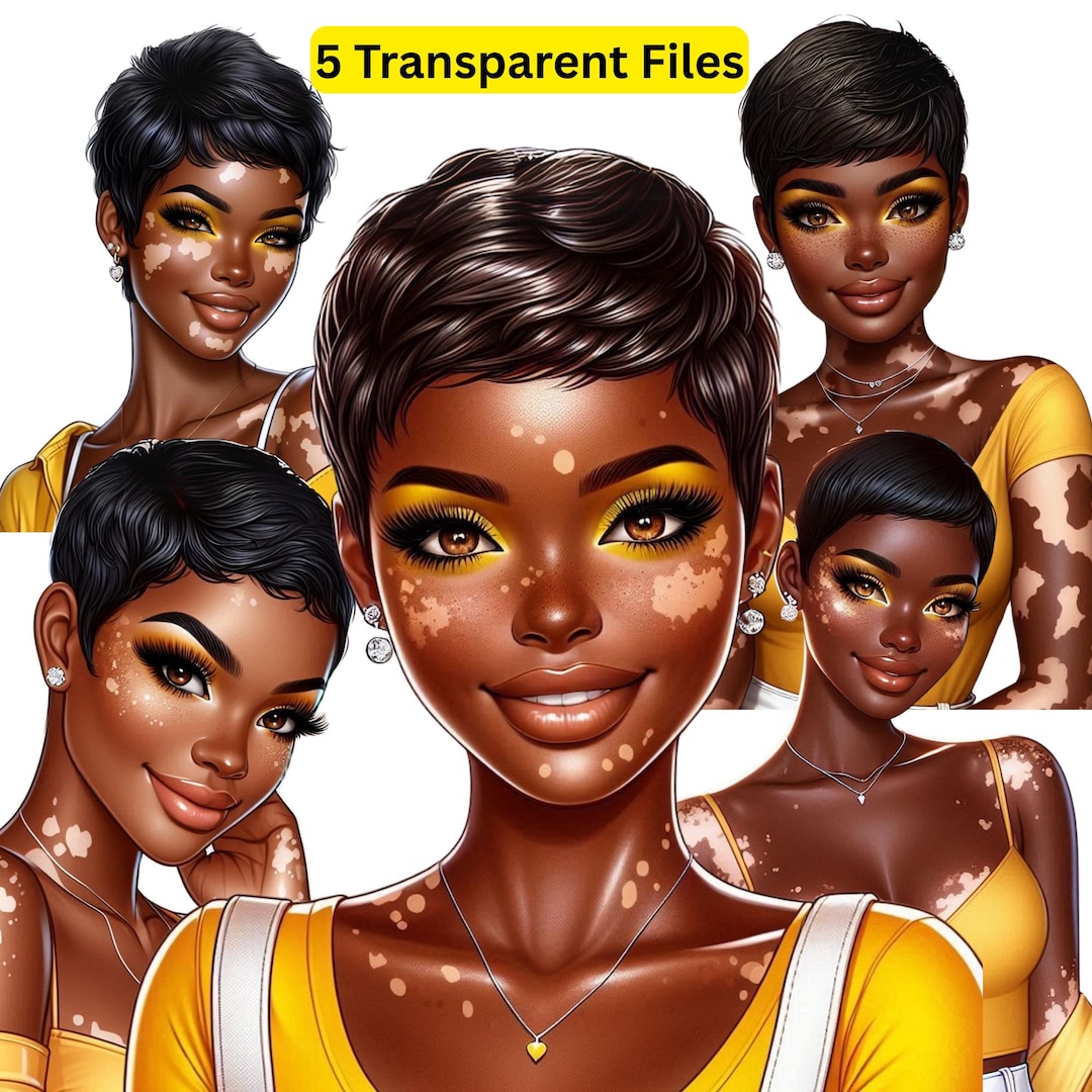 Vitiligo Awareness | Beautiful Black Woman With Vitiligo PNG ...