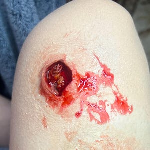 Bullet Wound Prosthetic Pack (Entry & Exit)